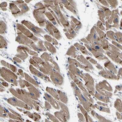 Immunohistochemistry-Paraffin: INPP5A Antibody [NBP1-89361]