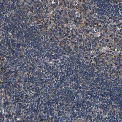 Immunohistochemistry-Paraffin: INPP5A Antibody [NBP1-89361]