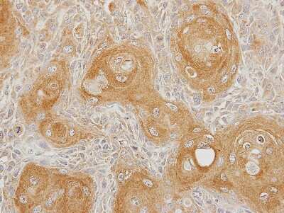 Immunohistochemistry-Paraffin: INPP5B Antibody [NBP1-31705]