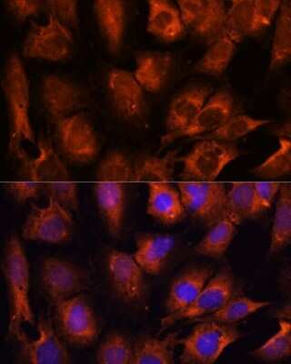 Immunocytochemistry/ Immunofluorescence: INPP5E Antibody - Azide and BSA Free [NBP3-05081]