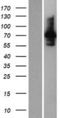 Western Blot: INPP5E Overexpression Lysate [NBP2-06696]