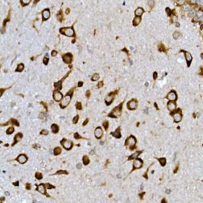 Immunohistochemistry-Paraffin: INSIG-2 Antibody - Azide and BSA Free [NBP3-03000]