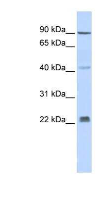 Western Blot: INSIG-2 Antibody [NBP1-59687]