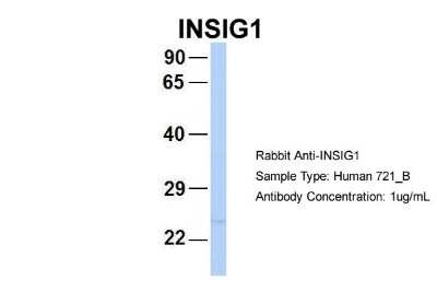 Western Blot: INSIG-2 Antibody [NBP1-59687]