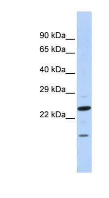Western Blot: INSIG-2 Antibody [NBP1-60007]