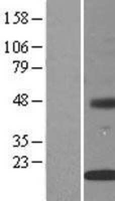 Western Blot: INSIG-2 Overexpression Lysate [NBL1-12004]