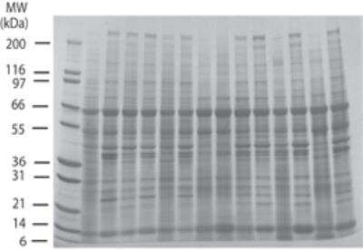 SDS-PAGE: INSTA-Blot Colon Tissue OncoPair [NBP2-30129]