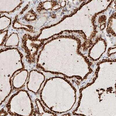 Immunohistochemistry-Paraffin: INTS1 Antibody [NBP1-85066]