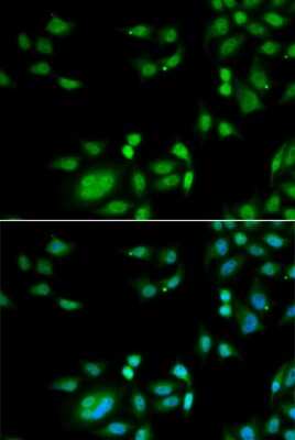 Immunocytochemistry/ Immunofluorescence: INTS10 Antibody - BSA Free [NBP3-05046]