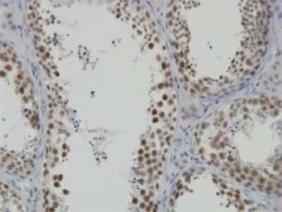 Immunohistochemistry-Paraffin: INTS6 Antibody (3D9) [H00026512-M02]