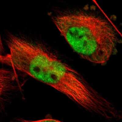 Immunocytochemistry/ Immunofluorescence: INTS6 Antibody [NBP1-85302]