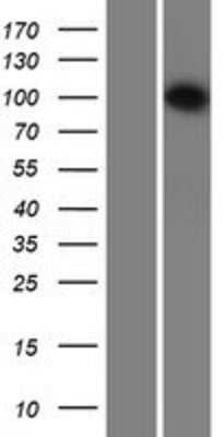 Western Blot: INTS6 Overexpression Lysate [NBP2-07487]