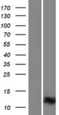 Western Blot: INTS6 Overexpression Lysate [NBP2-08537]