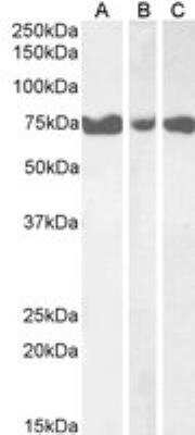 Western Blot: IP3KC Antibody [NBP1-36962]