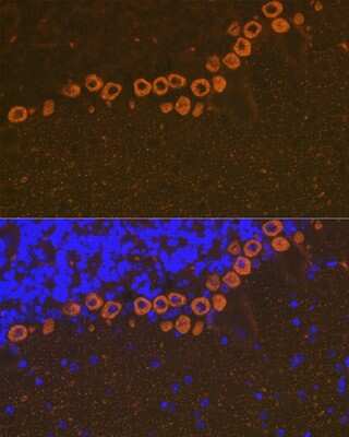Immunohistochemistry: IP3R1 Antibody (4Z1B6) [NBP3-16414]