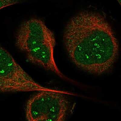 Immunocytochemistry/ Immunofluorescence: IP6K1 Antibody [NBP1-92026]