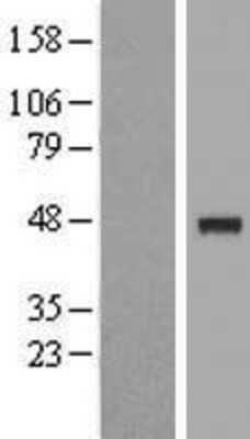 Western Blot: IP6K3 Overexpression Lysate [NBP2-05809]