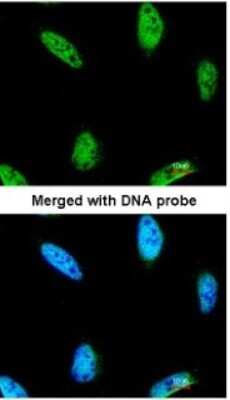 Immunocytochemistry/ Immunofluorescence: IPMK Antibody [NBP1-32250]