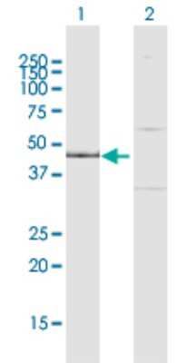 Western Blot: IPMK Antibody [H00253430-D01P]