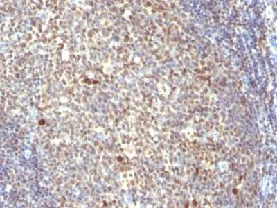 Immunohistochemistry-Paraffin: IPO-38 Antibody (IPO-38) [NBP2-45194]