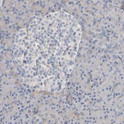 Immunohistochemistry-Paraffin: IPPK Antibody [NBP1-86712]