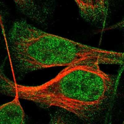 Immunocytochemistry/ Immunofluorescence: IQCE Antibody [NBP1-81447]