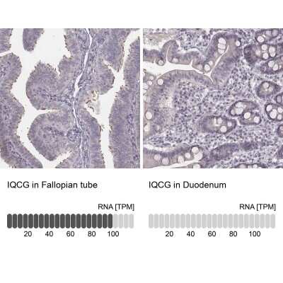 Immunohistochemistry-Paraffin: IQCG Antibody [NBP2-62622]
