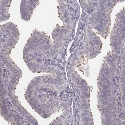 Immunohistochemistry-Paraffin: IQCG Antibody [NBP2-62622]