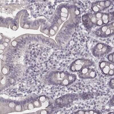 Immunohistochemistry-Paraffin: IQCG Antibody [NBP2-62622]