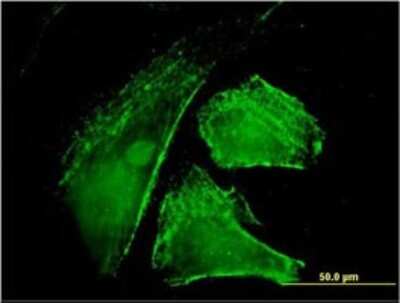 Immunocytochemistry/ Immunofluorescence: IQGAP1 Antibody (2C5) [H00008826-M01]