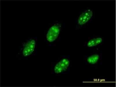 Immunocytochemistry/ Immunofluorescence: IQGAP3 Antibody (6E3) [H00128239-M01]