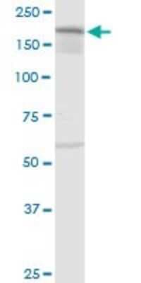 Western Blot: IQGAP3 Antibody [H00128239-D01P]