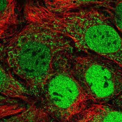 Immunocytochemistry/ Immunofluorescence: IQM1 Antibody [NBP2-55498]
