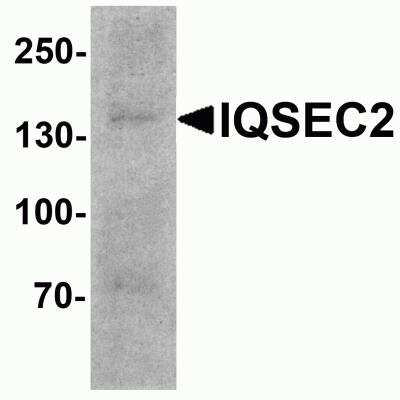 Western Blot: IQSEC2 AntibodyBSA Free [NBP2-81723]