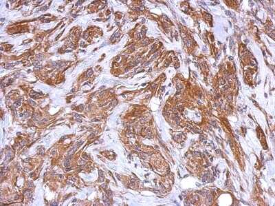 Immunohistochemistry-Paraffin: IRAG Antibody [NBP2-16987]