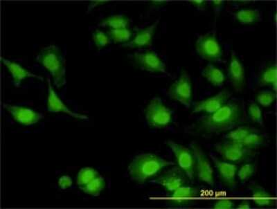 Immunocytochemistry/ Immunofluorescence: IRAK1 Antibody (3A9) [H00003654-M02]