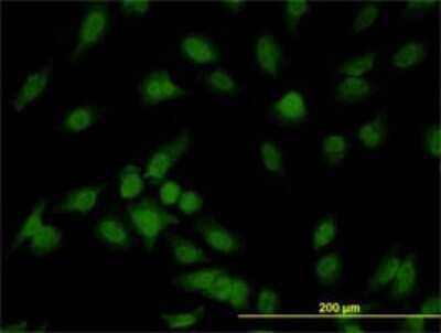 Immunocytochemistry/ Immunofluorescence: IRAK1 Antibody (3F7) [H00003654-M01]