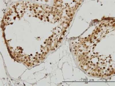 Immunohistochemistry-Paraffin: IRAK1 Antibody (3F7) [H00003654-M01]