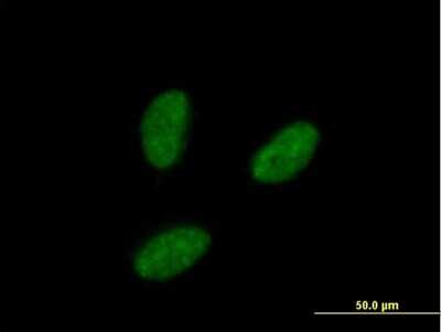 Immunocytochemistry/ Immunofluorescence: IRAK1BP1 Antibody [H00134728-B01P]