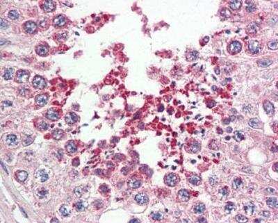 Immunohistochemistry-Paraffin: IRAK1BP1 Antibody [NBP1-31863]