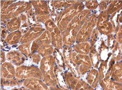 Immunohistochemistry-Paraffin: IRAK1BP1 Antibody [NBP1-31863]