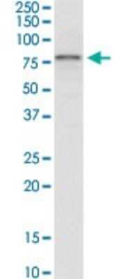 Western Blot: IRAK3 Antibody (1C9) [H00011213-M07]