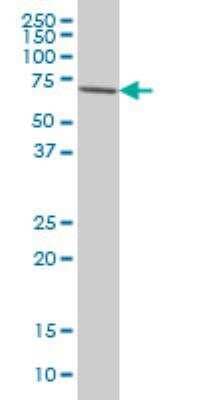 Western Blot: IRAK3 Antibody (1F6) [H00011213-M02]