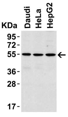 Western Blot: IRAK4 AntibodyBSA Free [NBP1-77231]