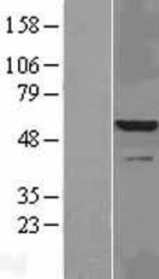 Western Blot: IRAK4 Overexpression Lysate [NBL1-12028]