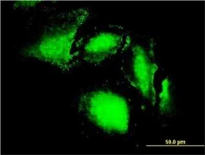 Immunocytochemistry/ Immunofluorescence: IRE1 alpha Antibody (8D12) [H00002081-M02]