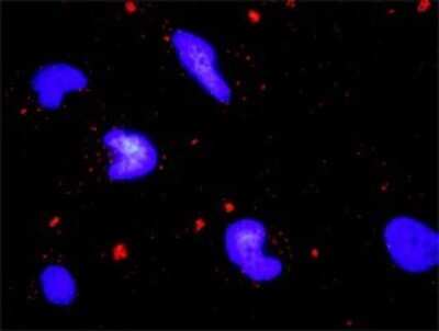 Proximity Ligation Assay: IRE1 alpha Antibody (8D12) [H00002081-M02]