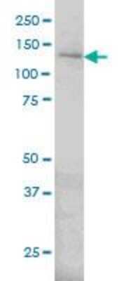 Western Blot: IRE1 alpha Antibody (8D12) [H00002081-M02]