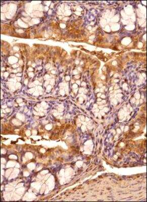 Immunohistochemistry-Paraffin: IRE1 alpha Antibody [NB100-2324]