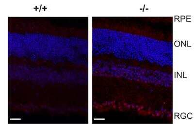 Immunohistochemistry: IRE1 alpha Antibody Pack [NBP2-50067]